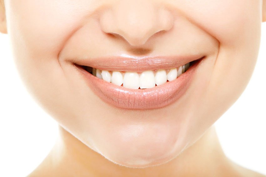 Teeth Whitening - Image 2